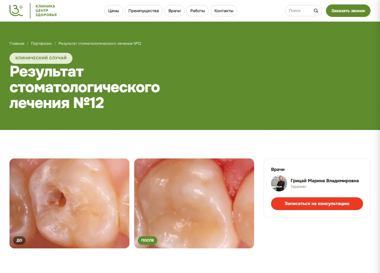 Карточка клинического случая: снимки до и после и врач, выполнивший работу
